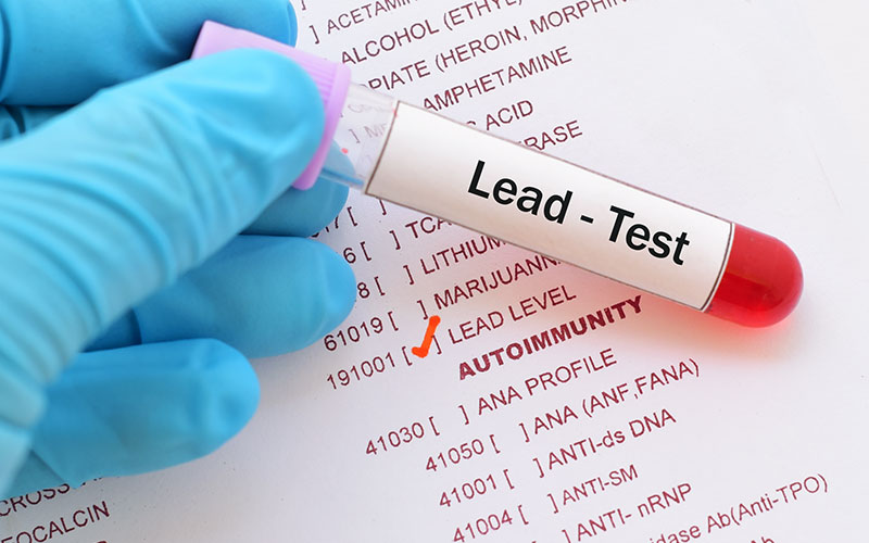 Lead poisoning test